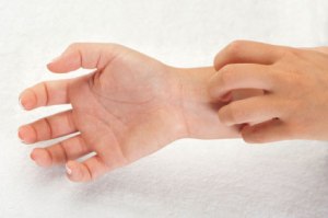 childscratchingeczema